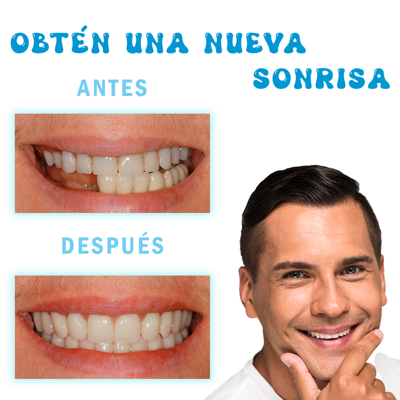 Dientes Postizos Moldeables