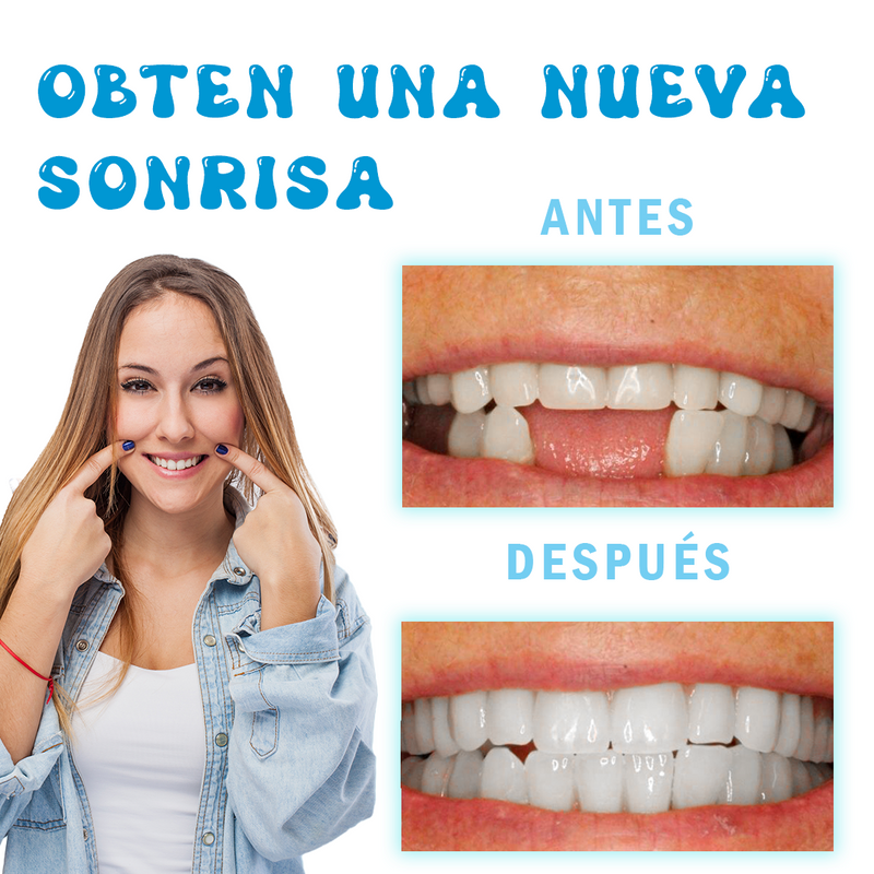 Dientes Postizos Moldeables